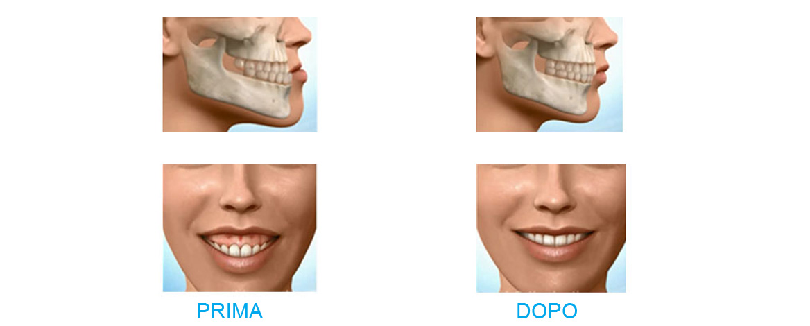 ORTODONZIA E TRATTAMENTO PATOLOGIE ATM